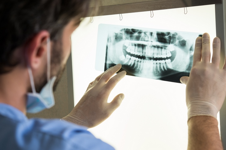 Ортопантомограмма (ОПТГ ) — двухмерное изображение зубов.